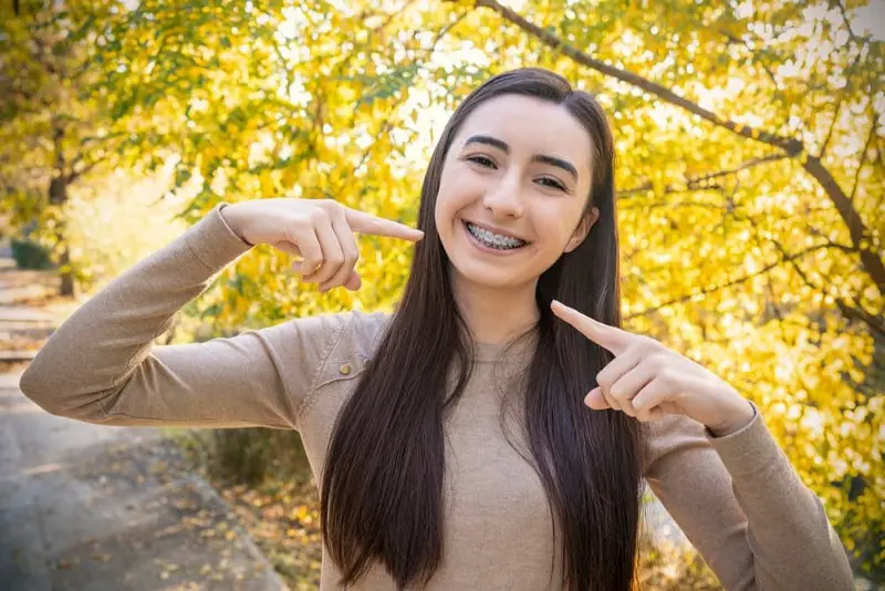 A smiling person with long dark hair points to their metal braces, capturing the result of orthodontist in Sammamish, WA.