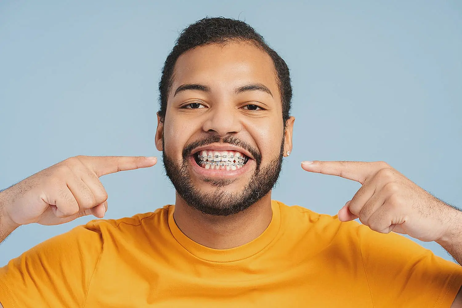 Man in a yellow shirt smiling and pointing at his braces in Sammamish, WA.