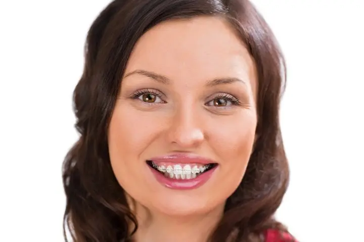 A person with dark hair smiles brightly, showcasing braces on their teeth against a white background, likely having visited an orthodontist in Kent or Sammamish, WA.