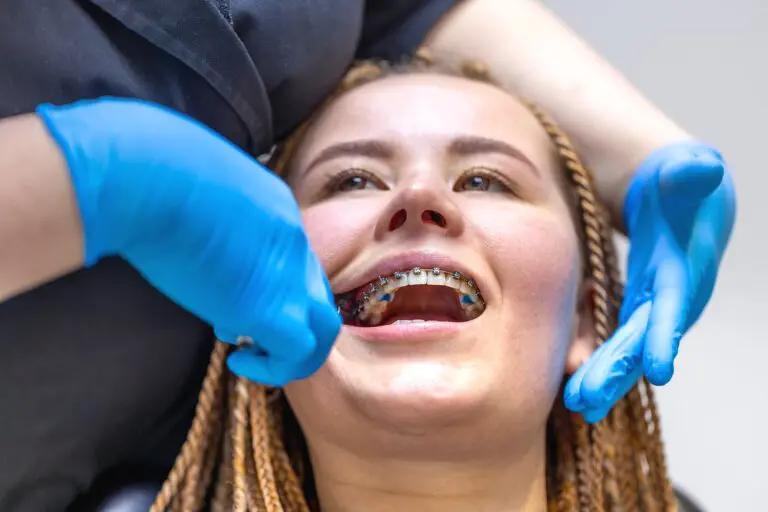 A person with braided hair and braces is having their teeth examined by a dental professional wearing blue gloves.