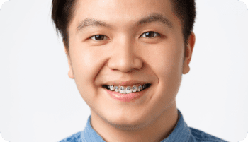 A young person with short dark hair smiles at the camera, confidently showing their metal braces, and is wearing a light blue collared shirt in Kent or Sammamish, WA.