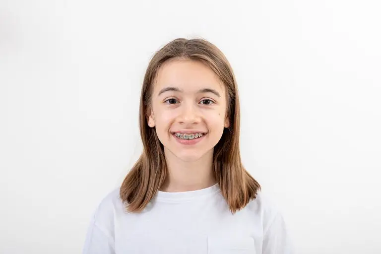 Young person with straight, shoulder-length brown hair smiling and wearing braces for overbite in Kent and Sammamish, WA, dressed in a plain white t-shirt, against a plain white background.