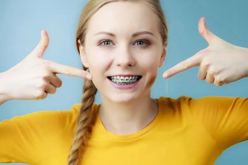 A person smiling proudly with their metal braces, points at their teeth with both index fingers. Sporting a braid and a cheerful yellow shirt, they stand against a vibrant blue background, showcasing the perfect smile crafted by an expert orthodontist in Sammamish or Kent, WA.
