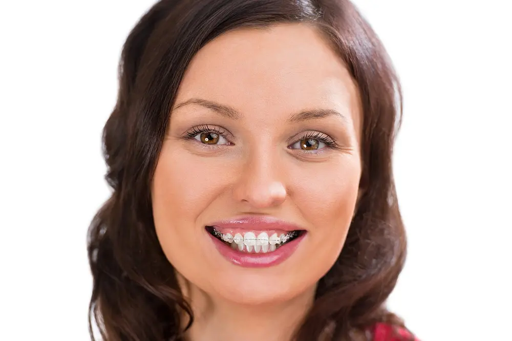 Woman smiling and looking at the camera - Overbite vs Underbite in Kent and Sammamish, WA.